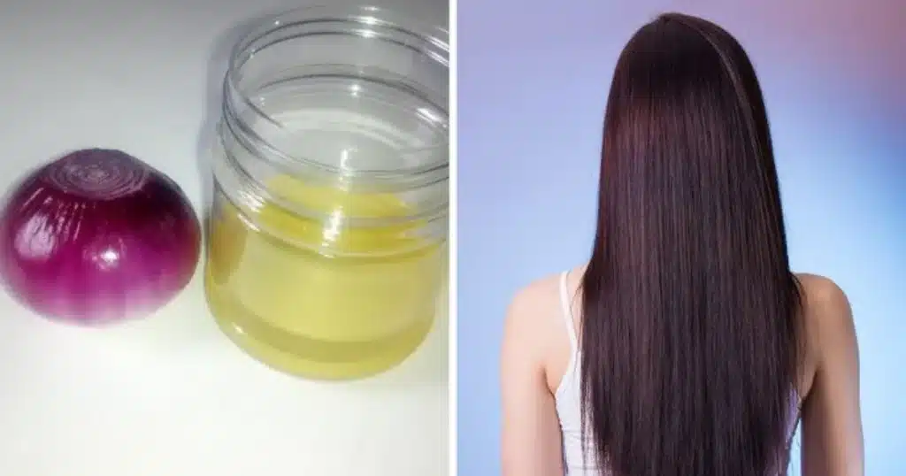 Huile Oignon Ail Cheveux : Le Secret Révélé en 5 Étapes pour une Pousse Incroyable 2 Huile Oignon Ail Cheveux