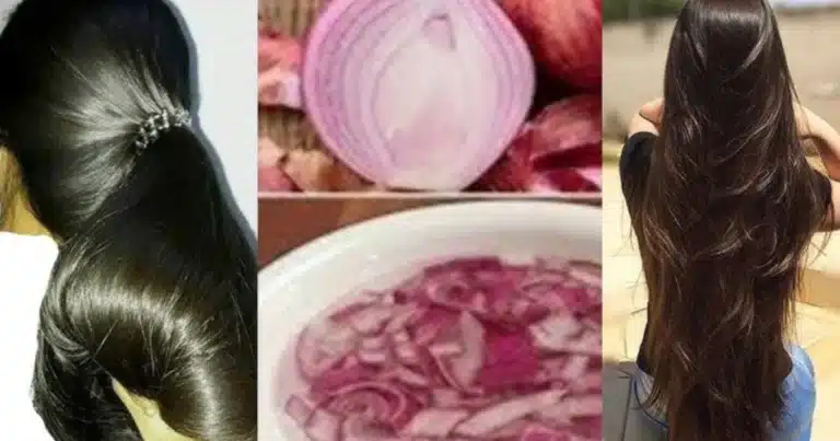 Huile Oignon Ail Cheveux : Le Secret Révélé en 5 Étapes pour une Pousse Incroyable