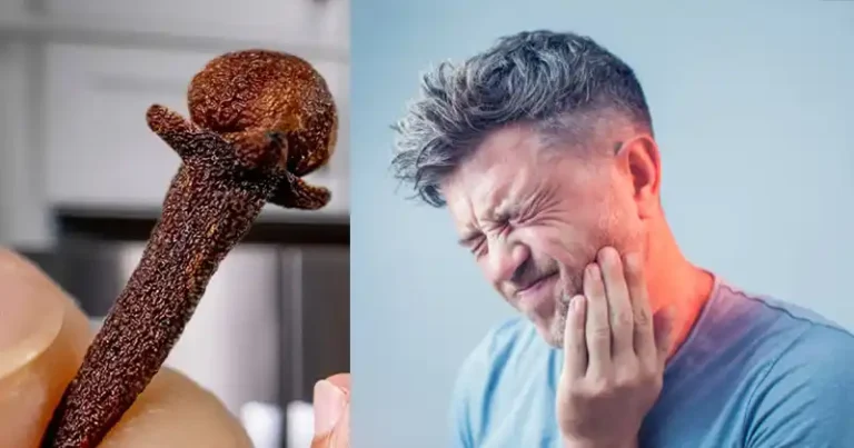 Tenir des clous de girofle dans votre bouche : une façon naturelle de soulager les maux de dents